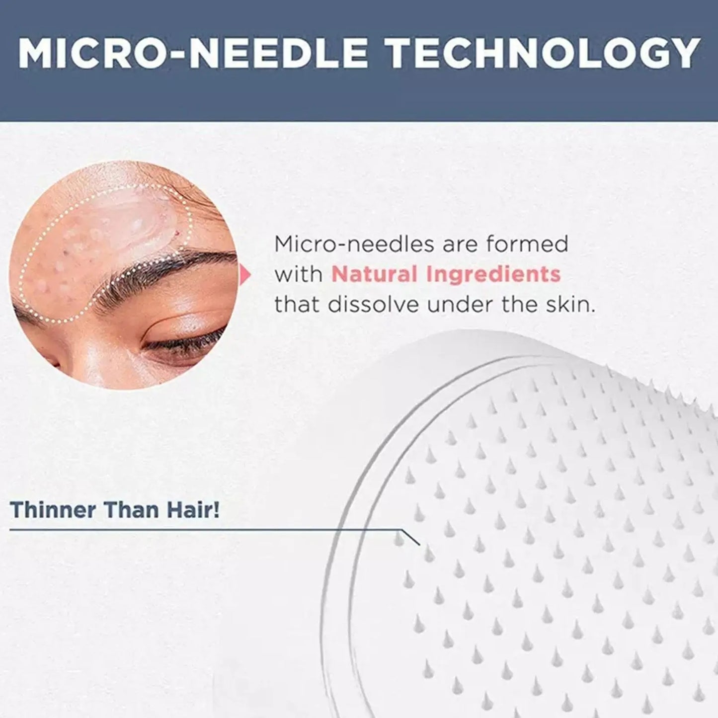 Microneedle Eye Patches